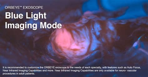 ORBEYE Exoscope Blue Light Imaging Mode Now Available.